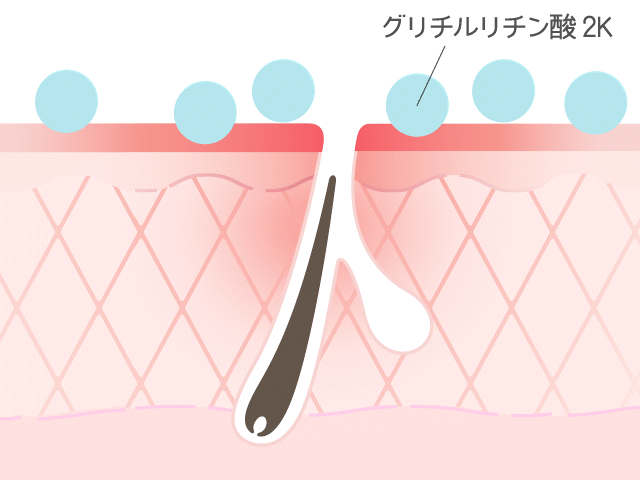 肌図